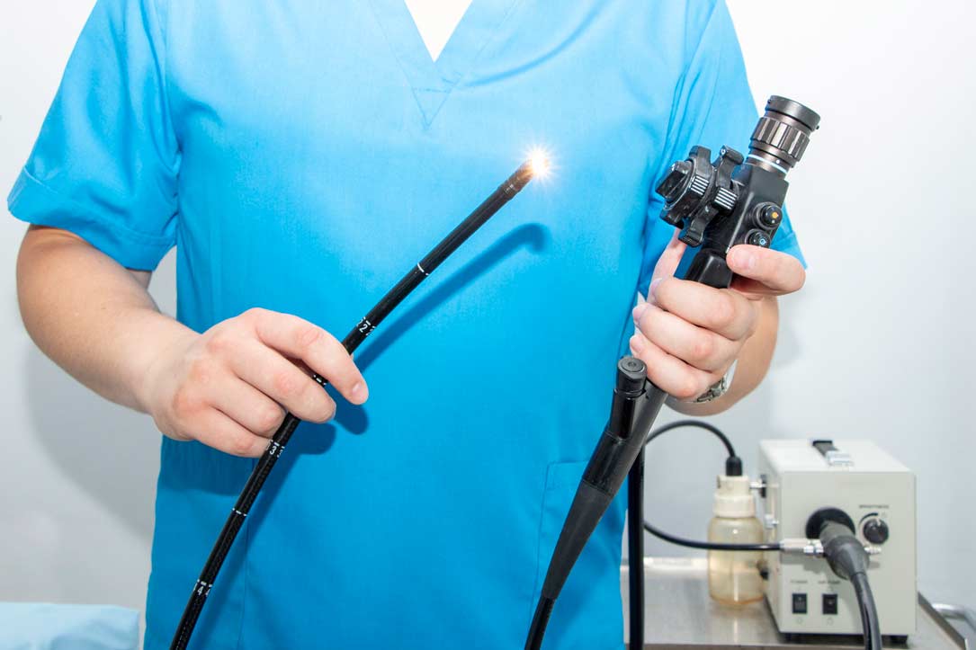 Upper Gi Endoscopy Who Should Have It When And Why Hospitals Magazine